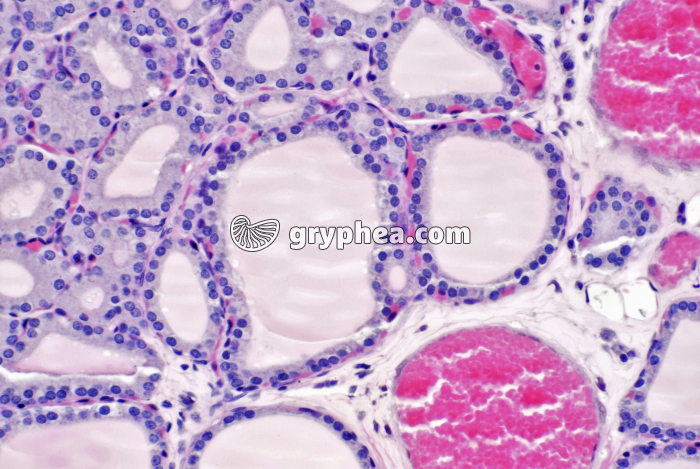 Thyroïde x100 - gryphea.com